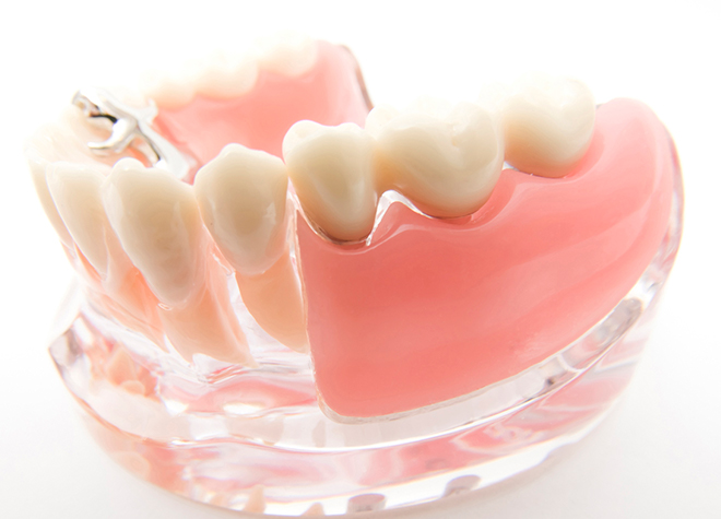 歯肉の状態を見極め、患者さまのお口に合った入れ歯を作製します