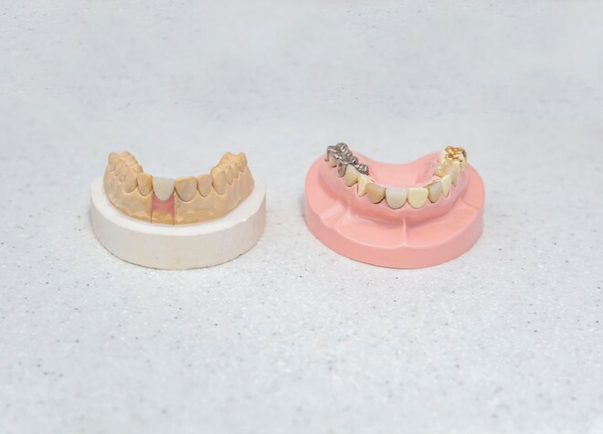 見た目が自然で機能性に富んだセラミック素材をご用意しています