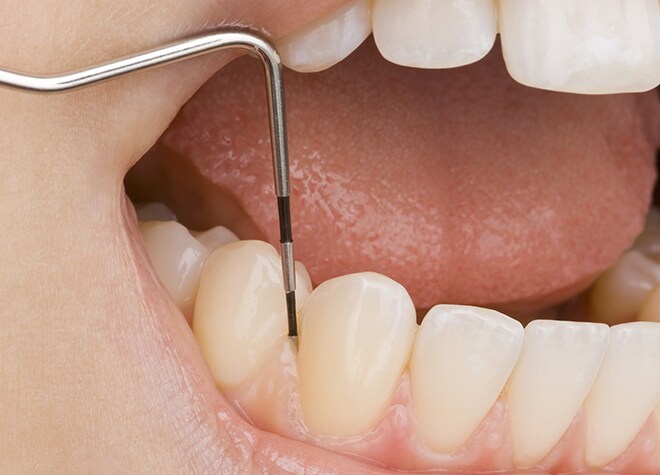 歯周病の治療内容 かただ歯科 堺市南区 泉ヶ丘駅 Epark歯科