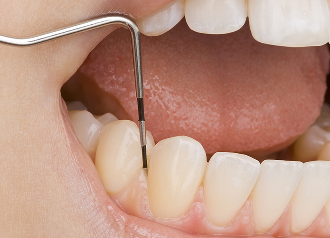 歯周病は初期症状に気付きにくいため、歯茎に異変を感じたらご来院ください