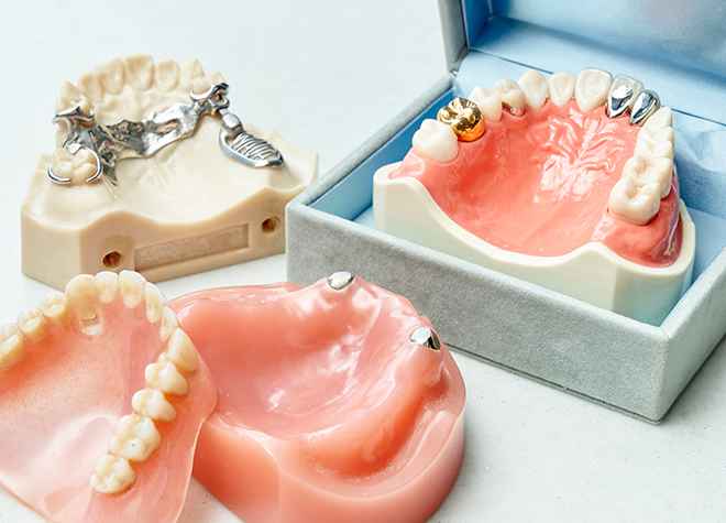 患者さまそれぞれに合った入れ歯・義歯をご提供します