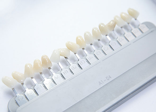 歯に負担の少ないホワイトニングで、白さを手にいれてみませんか？