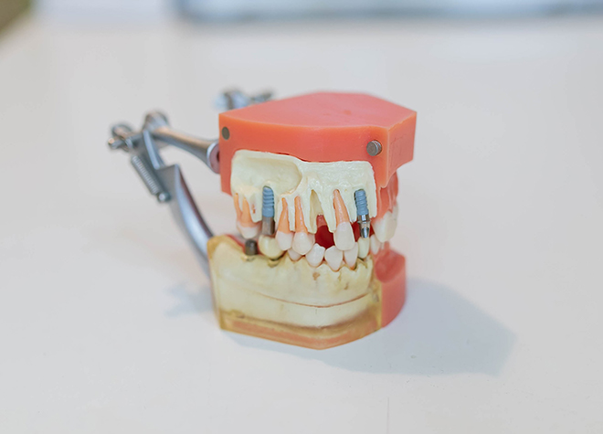 歯周病の検査を細かく行い、その結果を参考に患者さまのお口に合った治療方法をご提案します