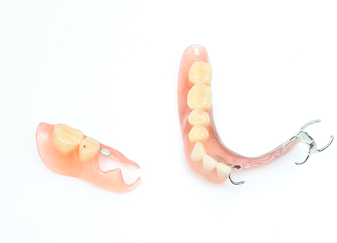 保険診療の入れ歯以外に、目立ちにくい自由診療の入れ歯も用意しています