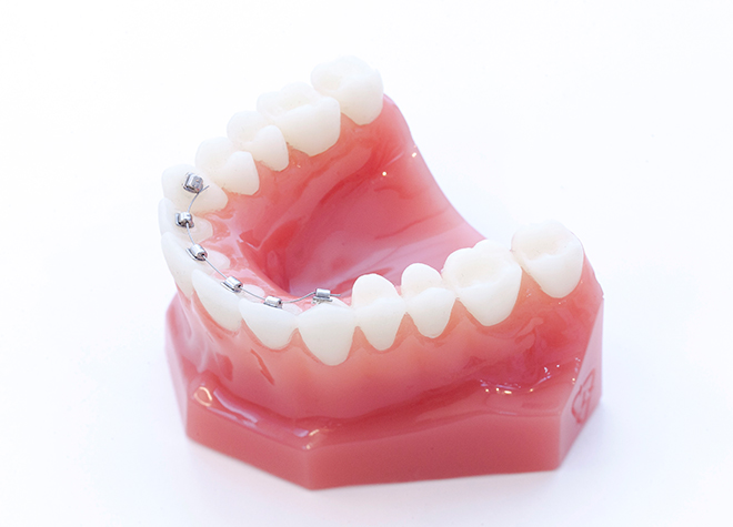 複数の方法を組み合わせることで、比較的短期間でも歯並びの改善が可能になります