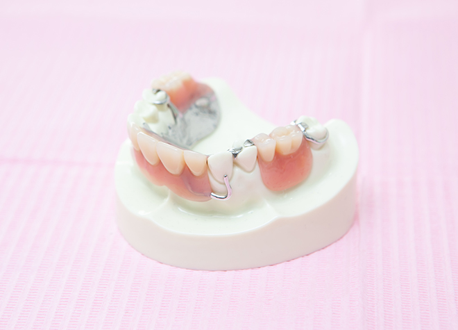 幅広い選択肢の中から、患者さまのご希望に合った入れ歯治療をご提案します
