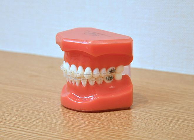 歯並びはもちろん、歯の形までも考慮した治療計画を立てることが可能です