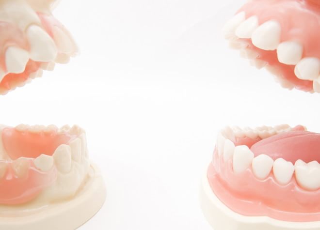 失った歯の代わりは入れ歯をご提案。入れ歯もいろいろ選べるので、まずはご相談ください。
