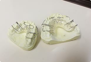 矯正治療について