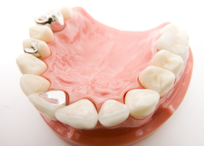 保険診療・自由診療ともに白い人工歯をご用意し、スピーディーに作製しています