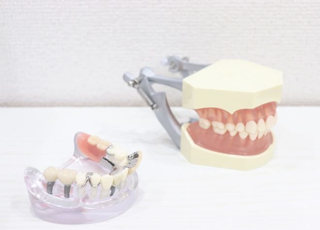 インプラントは、自然なかたちで失った歯を補うことができる治療です