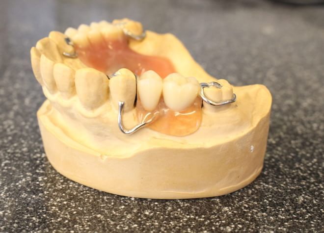 Q.入れ歯を作製する時に注意していることはありますか？