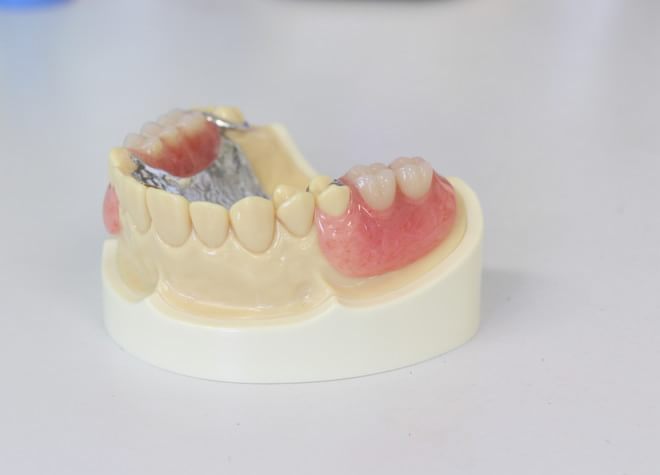 患者さまのご要望に添いつつも、しっかり噛める入れ歯を提供いたします