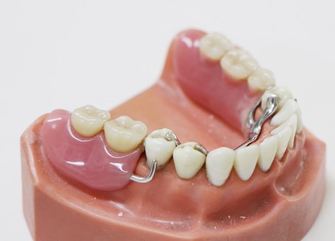 Q.入れ歯の修理はすぐにできますか？