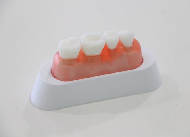 ただ白くするだけではなく、歯茎や歯の状態も診たうえで健康な白さをご提供しています