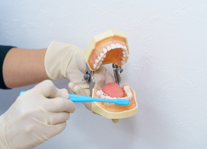 歯科衛生士によるブラッシング指導と歯石除去を受けて、お口の健康維持を目指しましょう