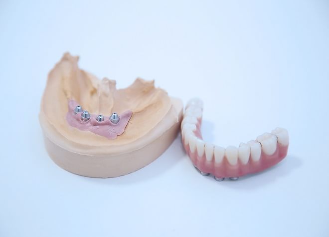 しっかり噛め、つけ心地の良い入れ歯を使っていただくため、様々な種類の入れ歯を用意