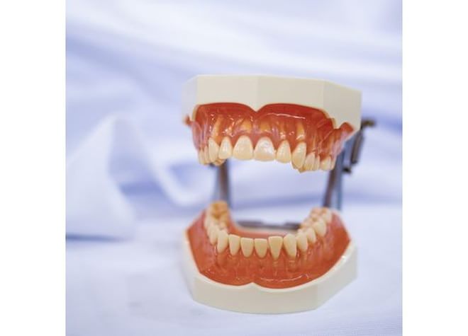 口腔内の状況をしっかりと把握し、患者さまのお口に馴染む入れ歯を作ります