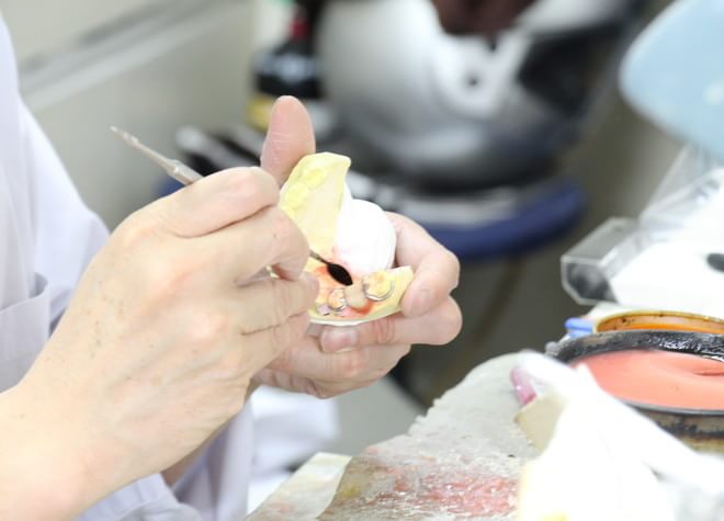 院内技工所で歯科技工士が入れ歯を作製、迅速かつ綺麗な仕上がり