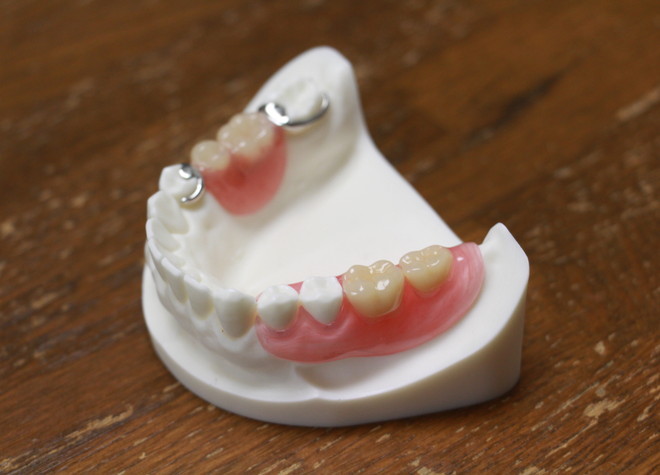 入れ歯はつくり方によってまったく異なるものができるため、慎重にご要望をお伺いしています