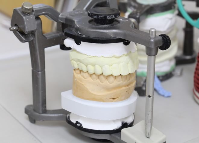 入れ歯は、完成後の調整をいかにこまめに行うかが重要です