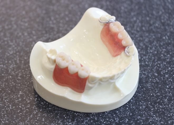 Q.入れ歯の作製で大切にしていることは何ですか？