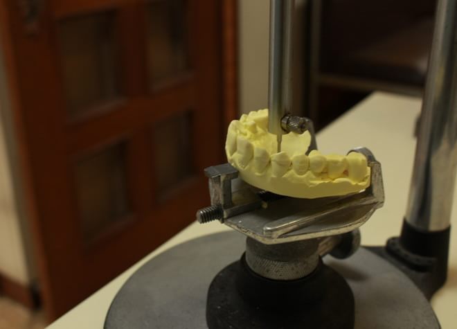 患者さまの噛み合わせや変化に合った入れ歯を提供します
