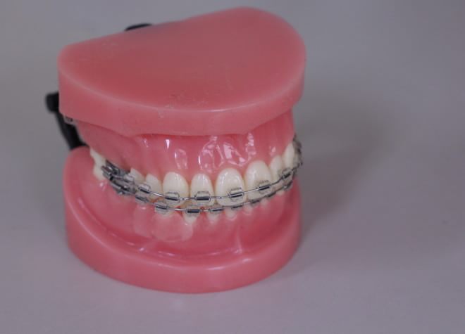 矯正に詳しい歯科医師と無料相談できます。歯並びを良くして、虫歯を予防しましょう