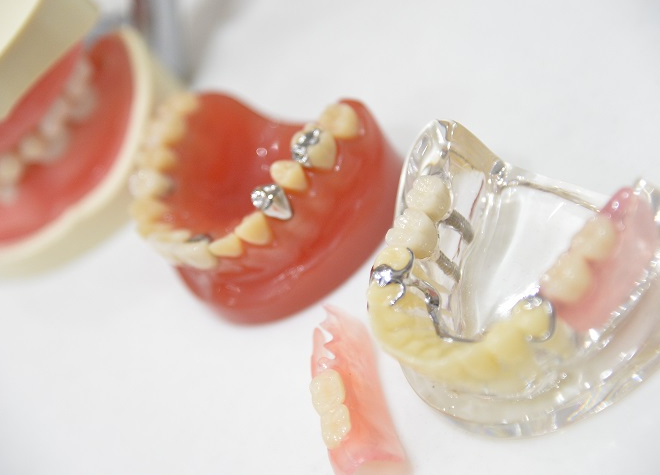 Q.使いやすい入れ歯を提供するための取り組みについて教えてください。