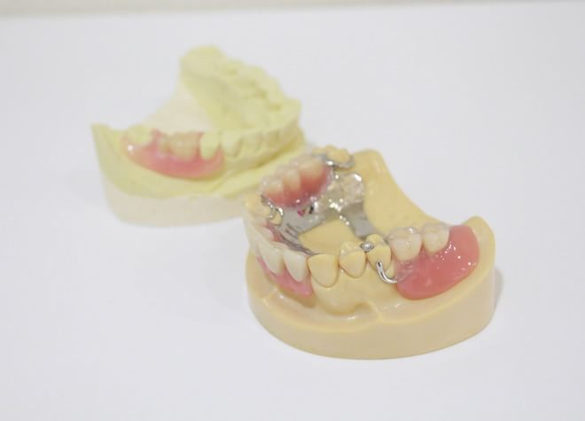 入れ歯治療は患者様の状況に応じて治療を進めます
