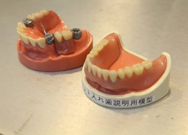 よりよい入れ歯の状況を保つためにも、定期的なメンテナンスを行う歯科医院