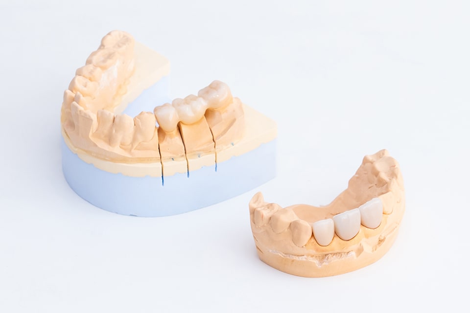 機能面と美しさに配慮し、患者さまにご納得いただける治療を行います