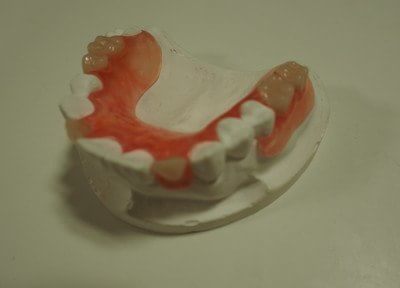 入れ歯治療について