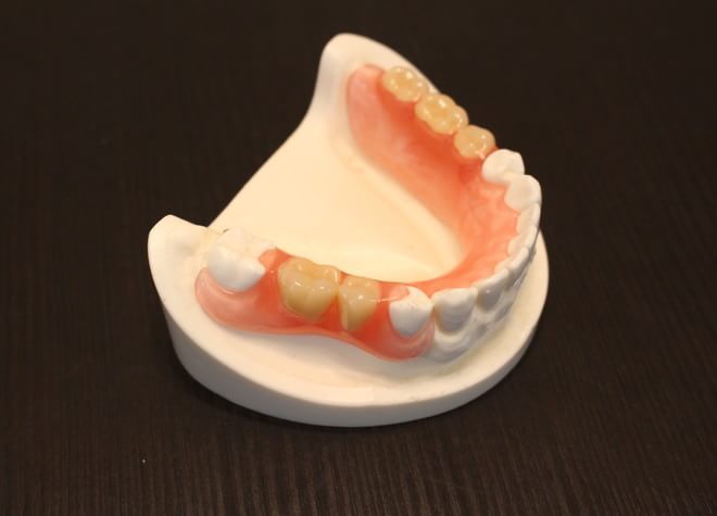 歯科技工所と連携し、オーダーメイドで「しっかりと噛める入れ歯」をご提供します
