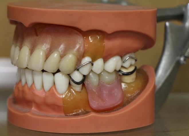Q.入れ歯の治療をする際に気をつけていることはありますか？