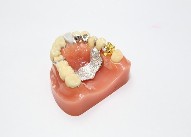 残っている歯の状態を考えて、患者さまのお口に合わせた治療をします