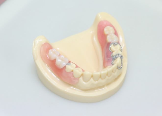 Q.どのような入れ歯を患者さまに提供していますか？
