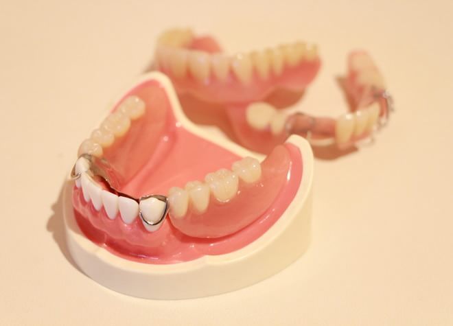 噛めることはもちろん、長期的に見て修正がきく入れ歯製作に努めます。