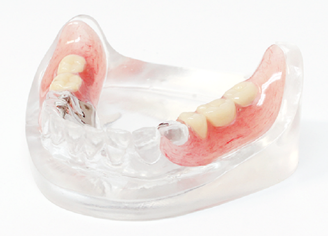 オーダーメイドで作製する柔軟なシリコン製の入れ歯を使用しています