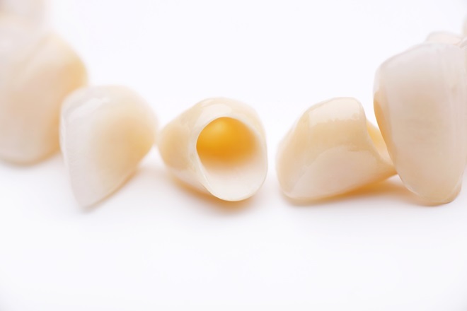 歯科技工所と連携を密にしたセラミック治療で、自然な白さのつめ物やかぶせ物をご提供します