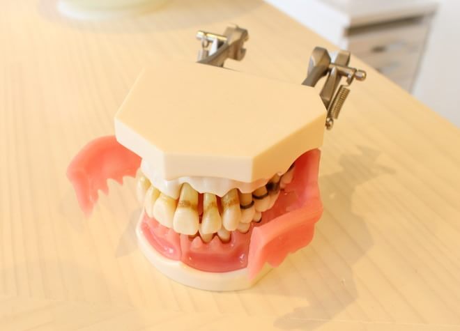 患者さまのお口の中を顕微鏡で細かくチェック。歯科衛生士がブラッシング方法をお教えします