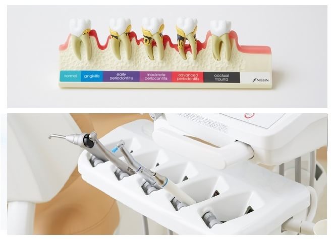 患者さまの健康な歯を失わないよう、歯科用CTを使用し、重度の歯周病でも対応いたします
